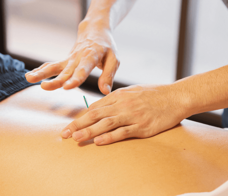 Dry Needling for Pain