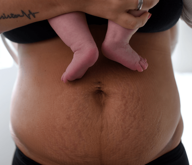 Case Study: Physical Therapy Interventions for Postpartum Urinary Retention